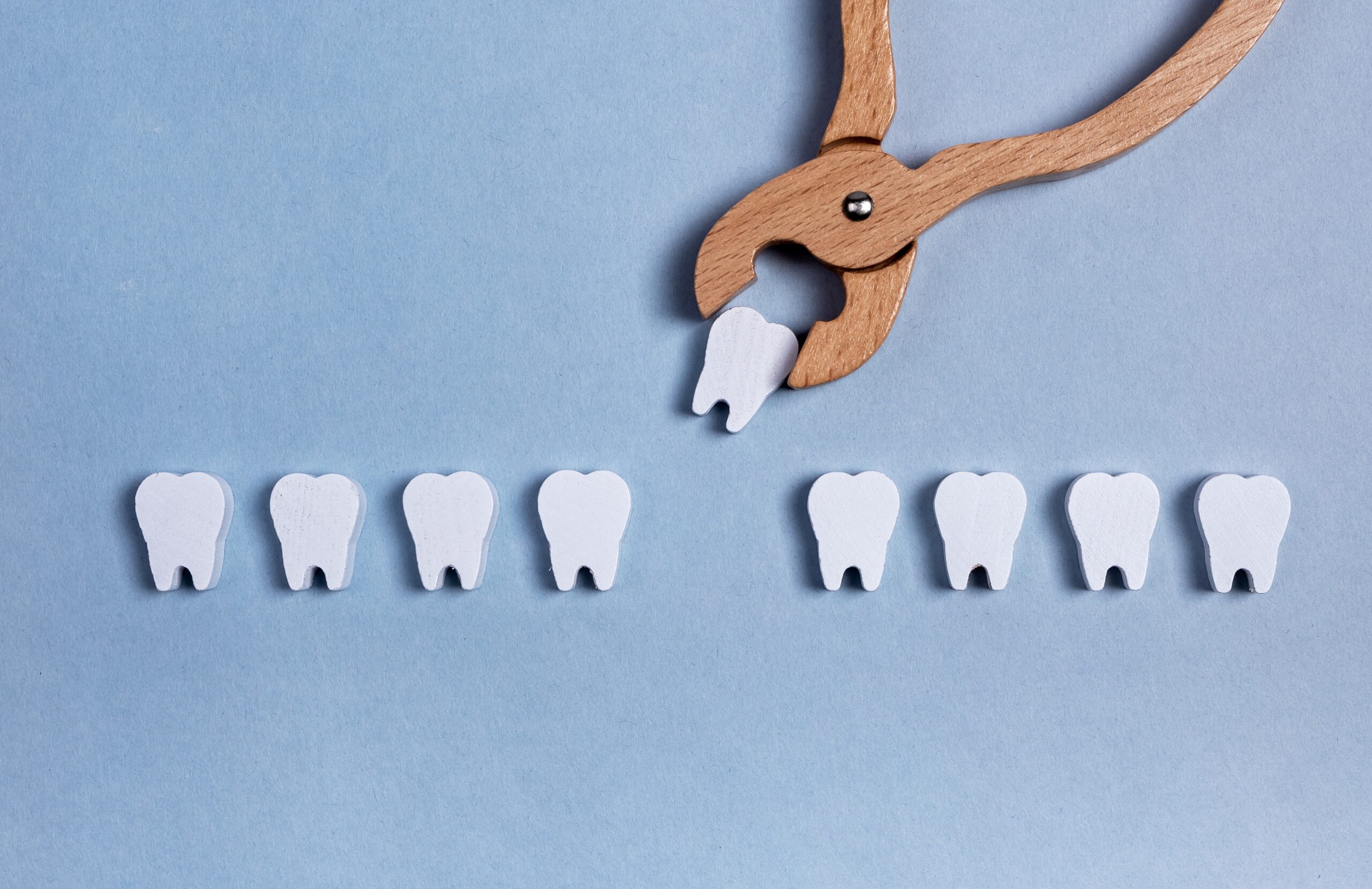 Tooth Extractions: What You Need to Know